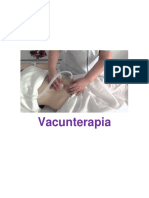 VACUMTERAPIA