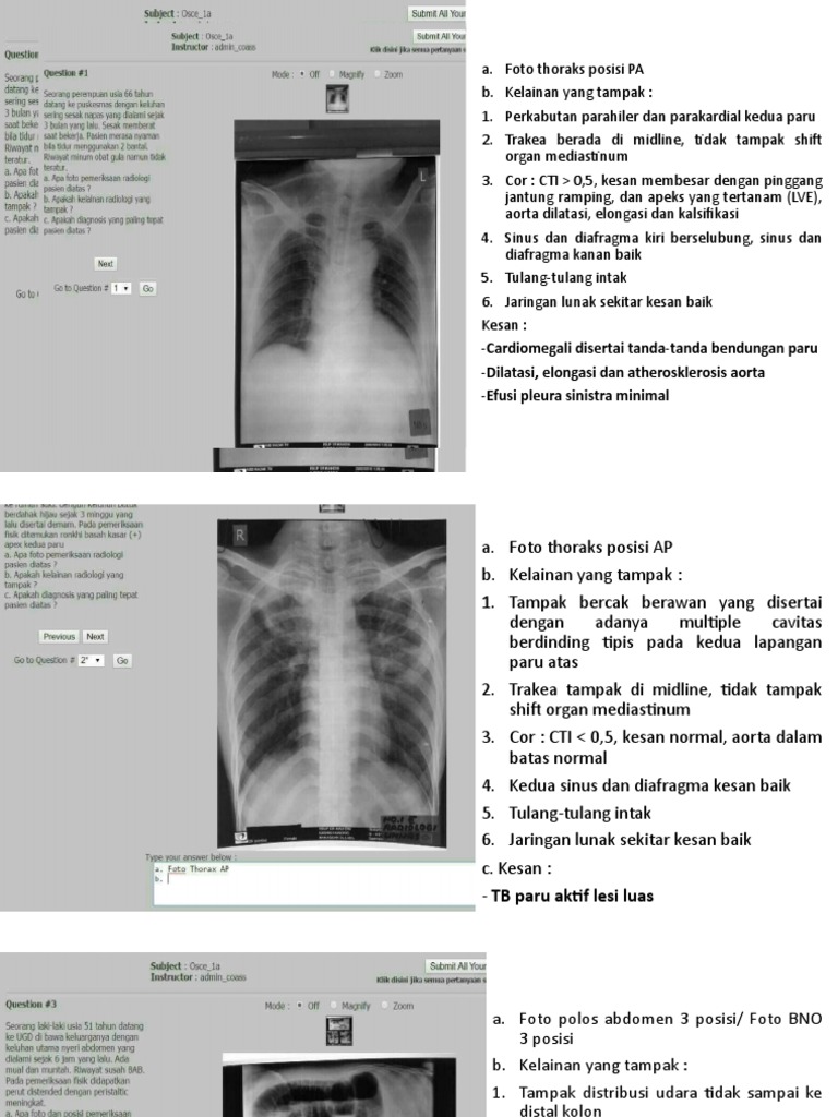 Hasil Foto Thoraks dan Abdomen Radiologi | PDF | Sains & Matematika