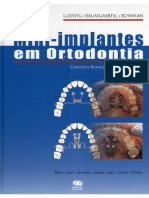 Mini Implantes em Ortodontia