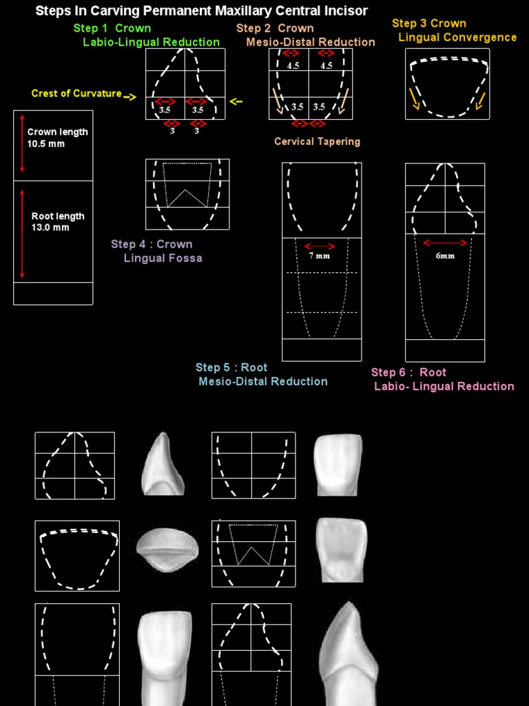 Carving of Permanent Maxillary Central Incisor 2 PDF