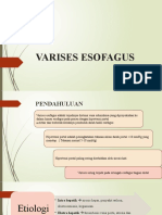 Varises Esofagus