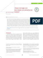 Má Oclusão de Classe I de Angle Com Biprotrusão Severa Tratada Com Extrações Dos Primeiros Pré-Molares