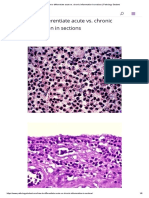 How To Differentiate Acute vs. Chronic Inflammation in Sections - Pathology Student