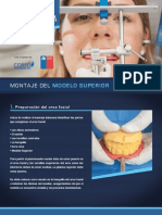 Dokumen - Tips Articulador WCM Montaje Del Modelo Superior 2014-7-15 Superior y La Parte