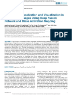 Lung Tumor Localization and Visualization in Chest