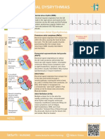 Nursing CS Common-Atrial-dysrythmias 02