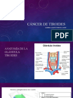 Cáncer de tiroides