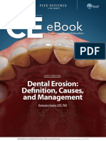 Dental Erosion Definition Causes and Management