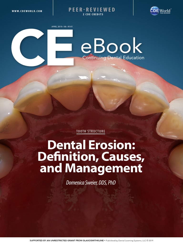 Dental Erosion Definition Causes and Management PDF Tooth Enamel