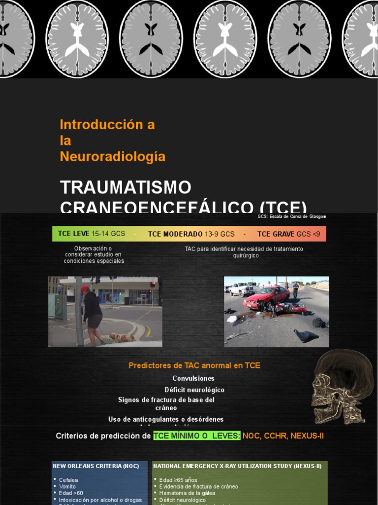 Neuroradiología: Diagnóstico TCE y EVC | PDF | Sistema nervioso ...