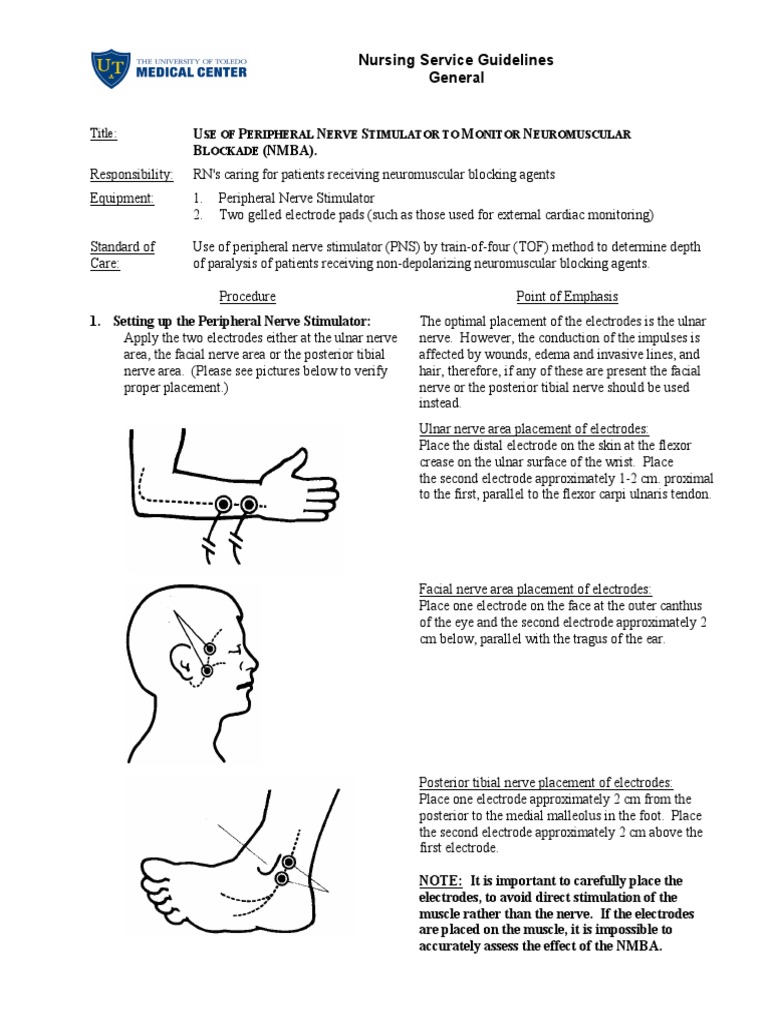 Use of Peripheral Nerve Stimulator To Monitor | Download Free PDF ...