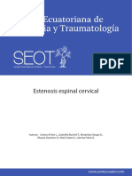 Estenosis Espinal Cevical