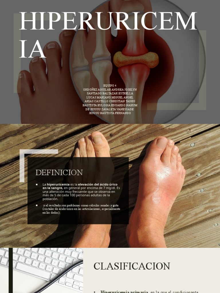 Clasificación y síntomas de hiperuricemia | PDF | Gota | Medicina CLINICA