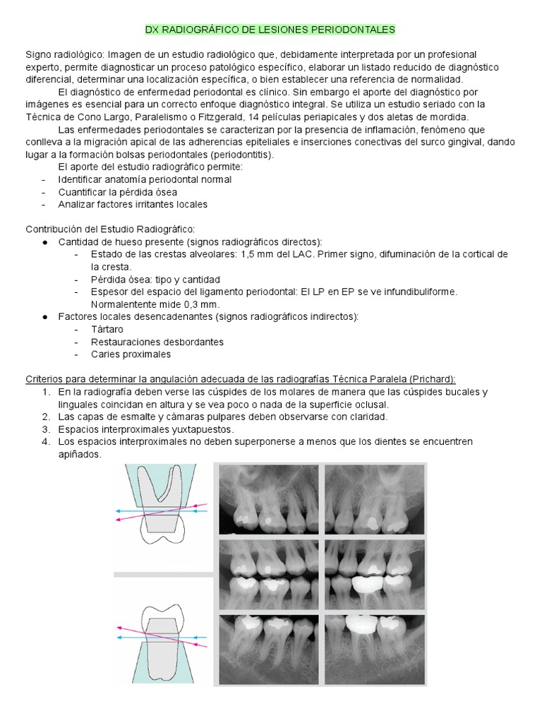 DX Radiográfico de Lesiones Periodontales | PDF | Ramas de Odontología ...