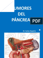 Tumores de Pancreas