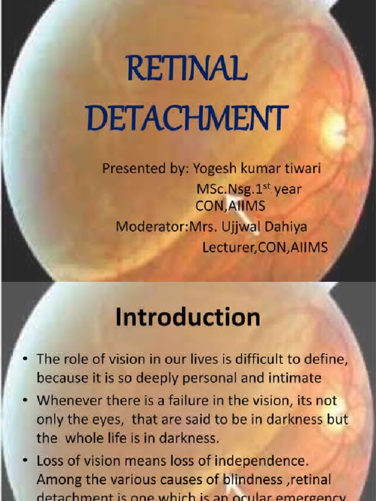 Retinal Detachment | PDF