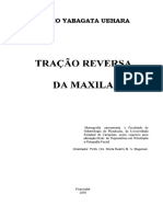 Tracao Reversa