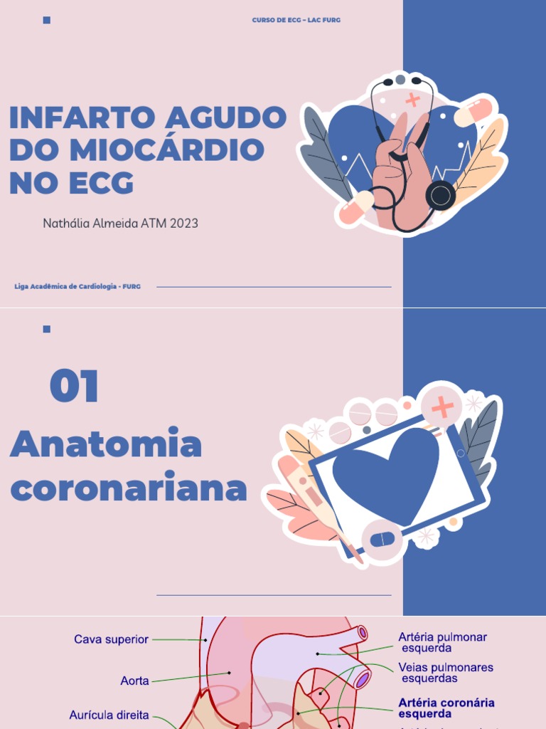 Iam No Ecg 2023 Lac | PDF | Infarto do Miocárdio | Isquemia