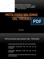 Patologias Malignas Tiroides