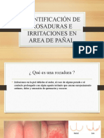 Identificación de Rosaduras e Irritaciones Abril