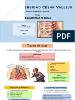 Traumatismo de Torax - Claudia Aquise