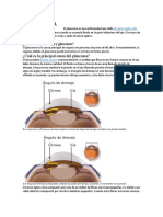 GLAUCOMA