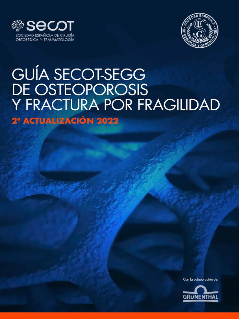 Guia Osteoporosis | PDF | Osteoporosis | Hueso