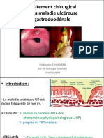 4 - Traitement Chirurgical Des MUGD