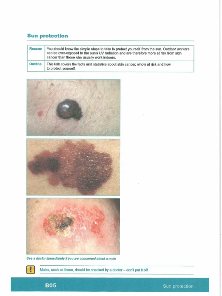 B05 Sun Protection PDF
