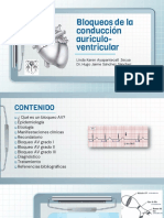 Revisión de Bloqueo de Conducción AV