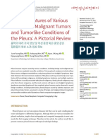 Various Benign and Maligna Tumors and Tumorlike Conditions of The Pleura
