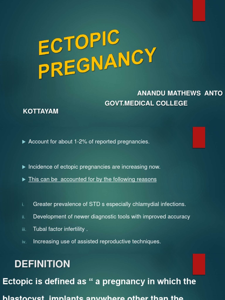 Ectopicpregnancy | PDF | Miscarriage | Pregnancy