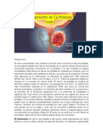 Tratamiento de Ca Próstata Insitu