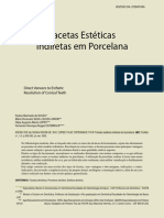 Extenso em Facetas Diretas e Indiretas Apostila03 - 230722 - 220823