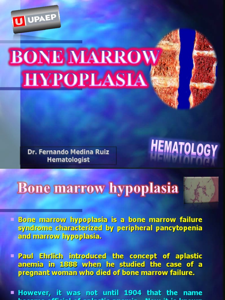 Bone Marrow Hypoplasia 2023 PDF Bone Marrow Hematopoietic Stem