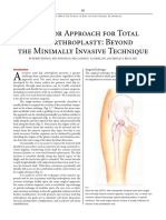 Anterior Approach For Total Hip Arthroplasty Beyond The Minimally Invasive Technique