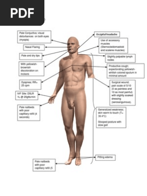 Body Map Post Op