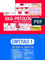 Ekg Patologico