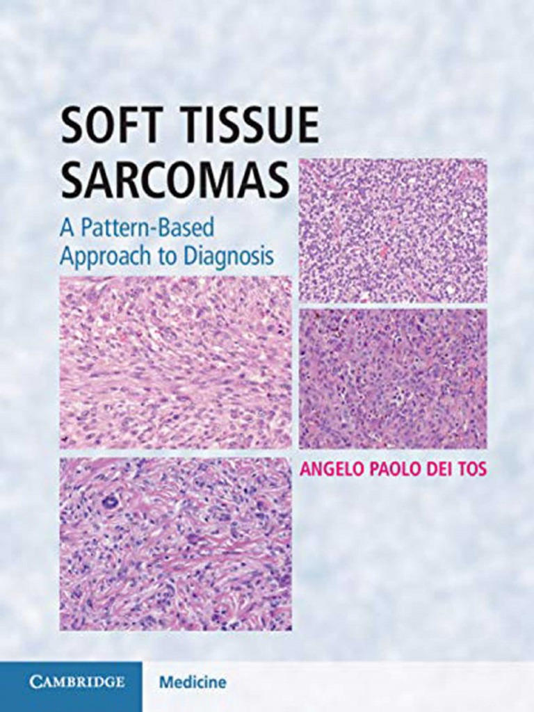 Soft Tissue Sarcomas | PDF | Sarcoma | Cancer