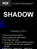 Chest X Ray CXR Basics Mbbs - PPT 111