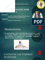 Exposicion Mastectomia