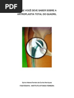 Artroplastia Total de Quadril - Ilustrado