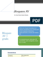 Bloqueos AV