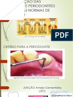 Classificação Das Gengivites e Periodontites Segundo As Normas II