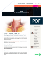 What Happens If Anal Fistula Is Not Treated On Time? - Dr. Samrat Jankar