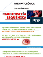 Cardiopatía Isquémica