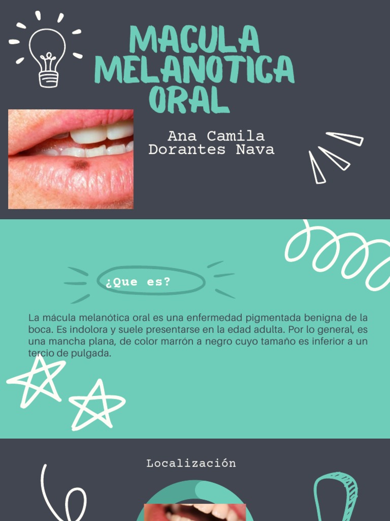 macula melanotica oral Mácula Melanótica: O que você precisa saber? main image 0