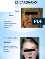 Facies Cardiacas