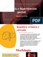 Paz Maryelis Cirrosis e Hipertensión Portal