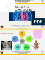 Absceso Pulmonar